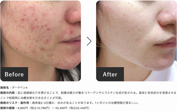 新宿美容外科BA画像