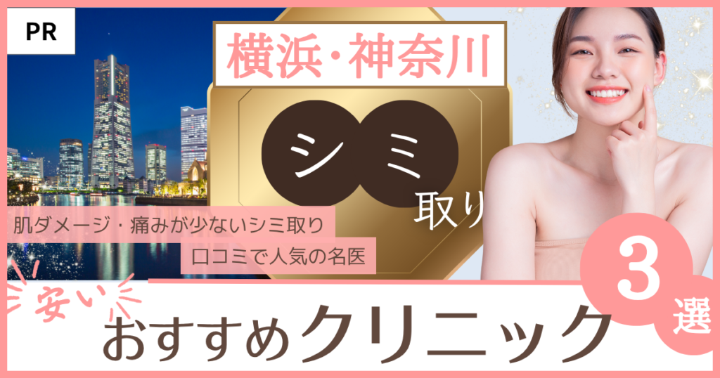 シミ取り 横浜・神奈川